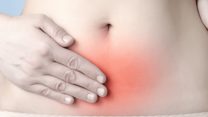 Treating Endometriosis and Boosting Fertility