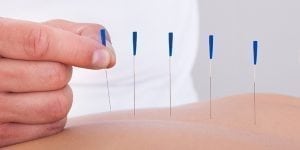 Overcome Infertility With Acupuncture