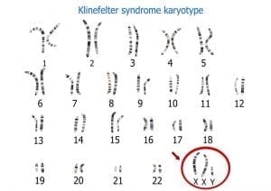 Treatment for klinefelter syndrome