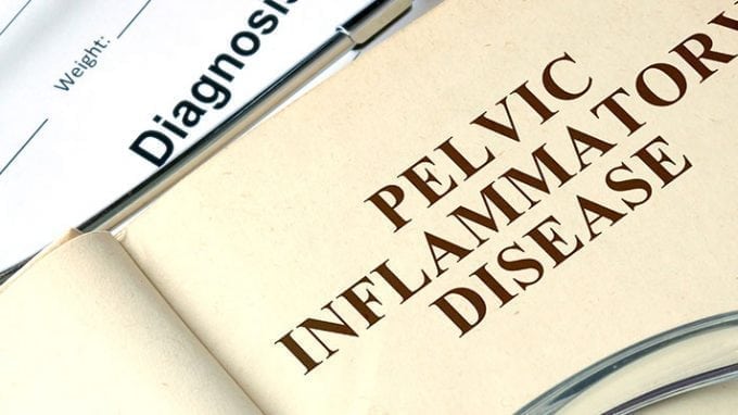 Pelvic Inflammatory Disease and the Impact on Fertility