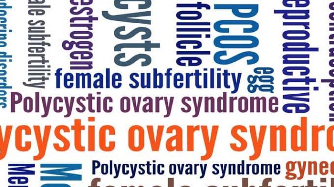 Image result for PCOS