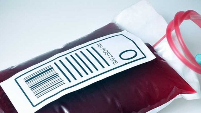 Type O Blood and the Link to Possible Fertility Issues