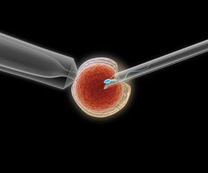 IVF for Male Factor Infertility