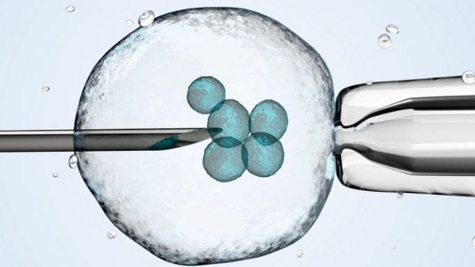 A Complete Guide to Zygote Intrafallopian Transfer