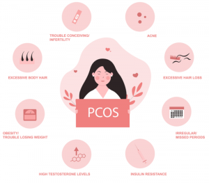 The Link Between PCOS and Recurrent Miscarriages