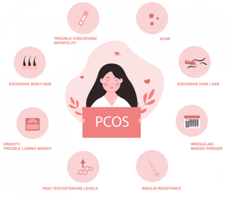 The Link Between PCOS and Recurrent Miscarriages