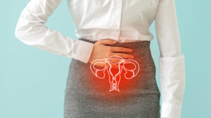 Does Endometriosis Lead to an Early Onset of Menopause?