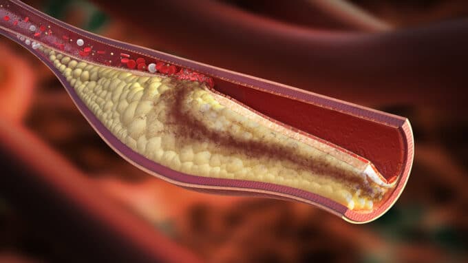 Certain Protein can Lower Cholesterol and Reverse Infertility