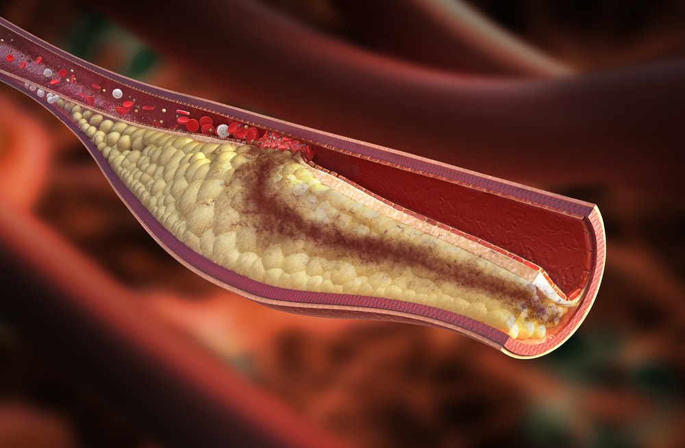 Certain Protein can Lower Cholesterol and Reverse Infertility