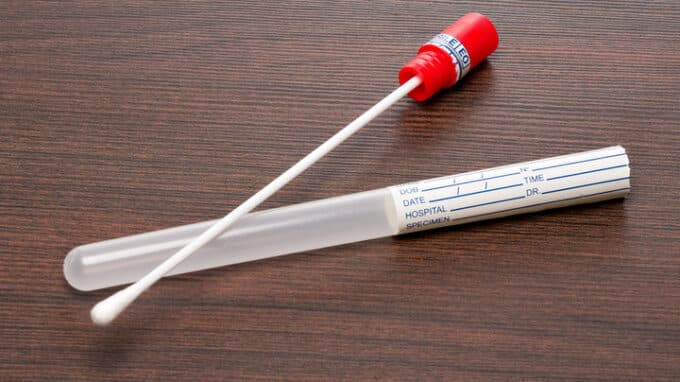 A Simple Mouth Swab Before IVF is Expected to Increase the Success Rate