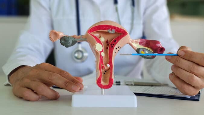 Study Shows: The Uterine Microbiome Could Influence the Success of IVF