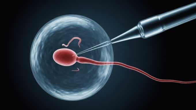IVF or ICSI: Is the More Complex Method Really Better?